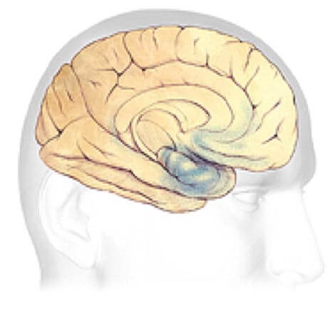 Progresión cerebral del Alzheimer