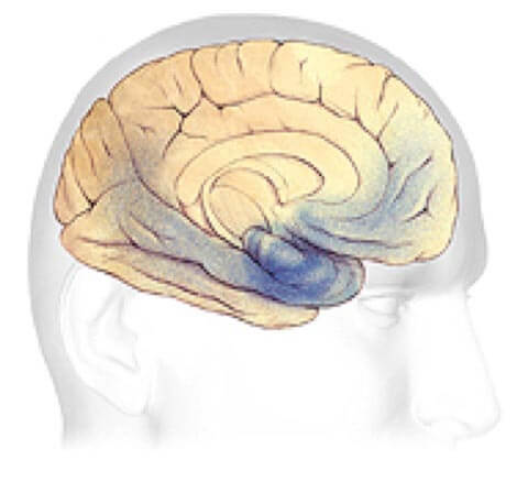 Progresión cerebral del Alzheimer