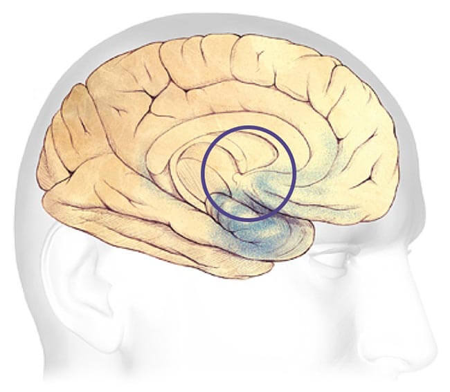 Las primeras etapas del Alzheimer