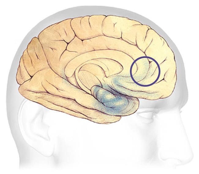 Las primeras etapas del Alzheimer