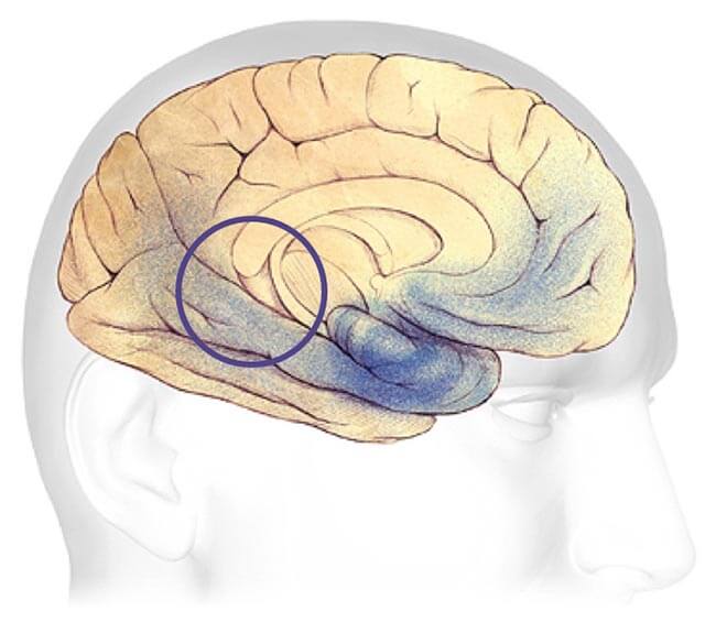 plaque-filled brains